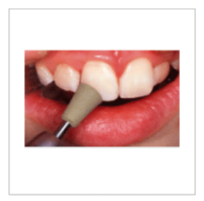 Picture for category Ceramic Polishers